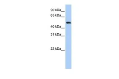 Anti-FAM175B antibody, Internal used in Western Blot (WB). GTX45284