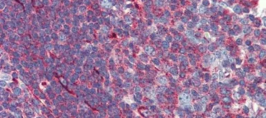 Anti-PHACTR1 antibody, Internal used in IHC (Paraffin sections) (IHC-P). GTX45287
