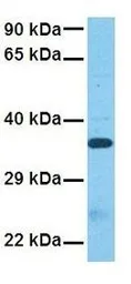 Anti-VGLL3 antibody, Internal used in Western Blot (WB). GTX45296