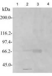 Anti-SENP3 antibody, N-term used in Western Blot (WB). GTX45298