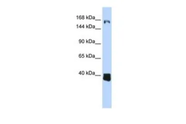 Anti-C10ORF12 antibody, Internal used in Western Blot (WB). GTX45300