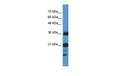 Anti-C1orf144 antibody, N-term used in Western Blot (WB). GTX45302