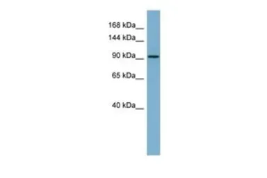Anti-RAI14 antibody, Internal used in Western Blot (WB). GTX45307