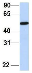 Anti-FAM98A antibody, Internal used in Western Blot (WB). GTX45308