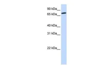 Anti-COG4 antibody, Internal used in Western Blot (WB). GTX45312