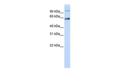 Anti-KIAA0892 antibody, Internal used in Western Blot (WB). GTX45314