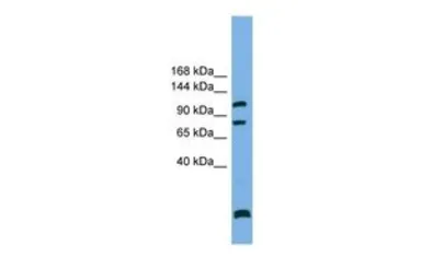 Anti-SAPS1 antibody, N-term used in Western Blot (WB). GTX45333