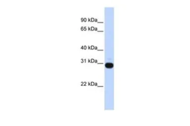 Anti-VASH1 antibody, Internal used in Western Blot (WB). GTX45335