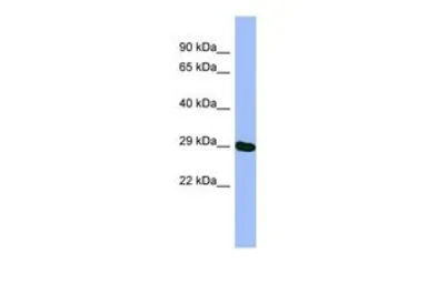 Anti-METTL5 antibody, N-term used in Western Blot (WB). GTX45350