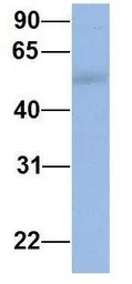 Anti-IFIT5 antibody, Internal used in Western Blot (WB). GTX45362