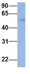 Anti-IFIT5 antibody, Internal used in Western Blot (WB). GTX45362