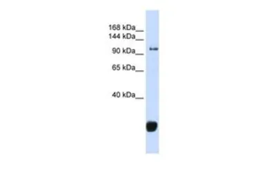 Anti-FBXO10 antibody, Internal used in Western Blot (WB). GTX45367