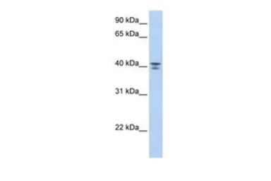 Anti-G protein alpha 12 antibody, Internal used in Western Blot (WB). GTX45376