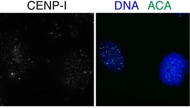 Anti-CENPI antibody, N-term used in Immunocytochemistry/ Immunofluorescence (ICC/IF). GTX45379