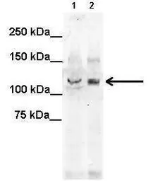 Anti-KIF5C antibody, N-term used in Western Blot (WB). GTX45388
