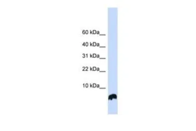 Anti-Glutaredoxin 1 antibody, N-term used in Western Blot (WB). GTX45389