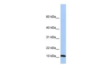 Anti-FAU antibody, Internal used in Western Blot (WB). GTX45390