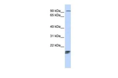 Anti-ICT1 antibody, Internal used in Western Blot (WB). GTX45391