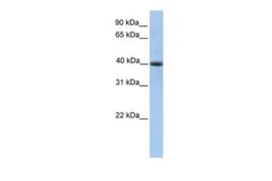 Anti-PELI3 antibody, N-term used in Western Blot (WB). GTX45398