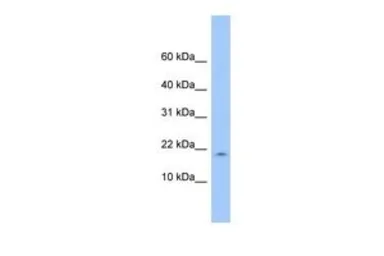 Anti-LOC285033 antibody, N-term used in Western Blot (WB). GTX45408