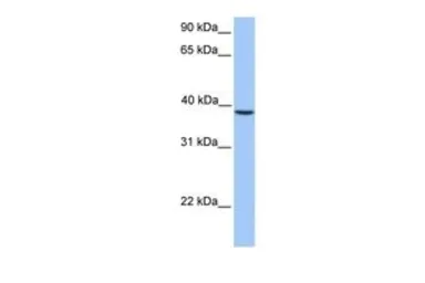Anti-SUNC1 antibody, C-term used in Western Blot (WB). GTX45411