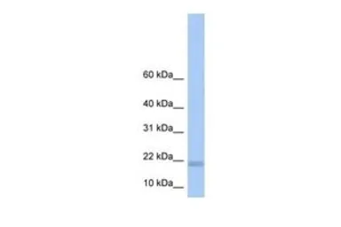 Anti-LOC284009 antibody, N-term used in Western Blot (WB). GTX45416
