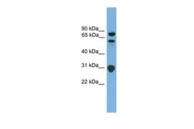 Anti-SH3KBP1 antibody, N-term used in Western Blot (WB). GTX45417