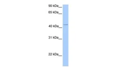 Anti-C17orf97 antibody, N-term used in Western Blot (WB). GTX45419