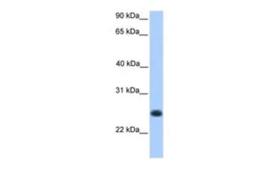Anti-C12orf68 antibody, Internal used in Western Blot (WB). GTX45421