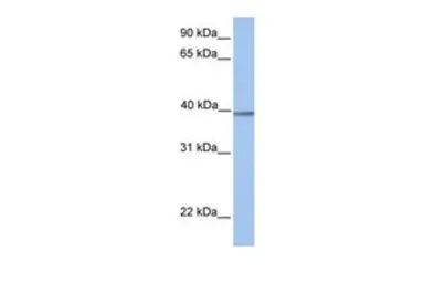 Anti-AMT antibody, N-term used in Western Blot (WB). GTX45441