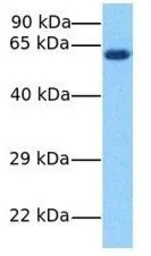 Anti-AMH antibody, Internal used in Western Blot (WB). GTX45442