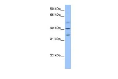 Anti-ZC3H14 antibody, N-term used in Western Blot (WB). GTX45443