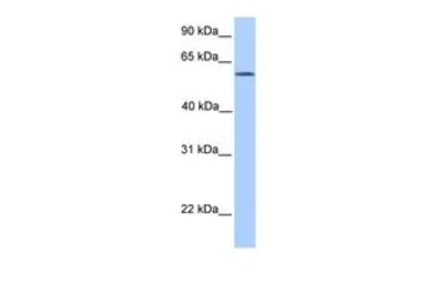 Anti-ACSBG2 antibody, Internal used in Western Blot (WB). GTX45456