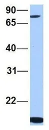 Anti-ARHGAP28 antibody, C-term used in Western Blot (WB). GTX45457