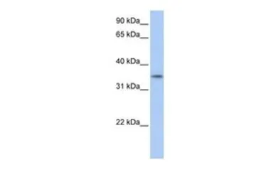 Anti-C17ORF39 antibody, C-term used in Western Blot (WB). GTX45461