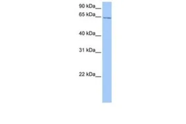 Anti-C2ORF42 antibody, C-term used in Western Blot (WB). GTX45468