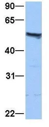 Anti-ISYNA1 antibody, N-term used in Western Blot (WB). GTX45473