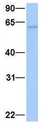 Anti-ISYNA1 antibody, N-term used in Western Blot (WB). GTX45473