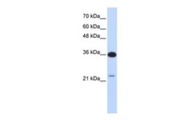 Anti-TP53TG5 antibody, Internal used in Western Blot (WB). GTX45476