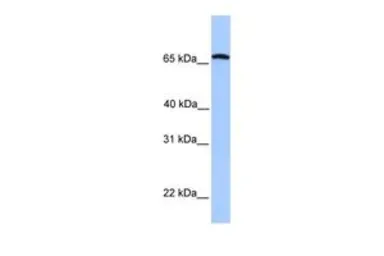 Anti-CCIN antibody, C-term used in Western Blot (WB). GTX45483