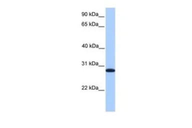 Anti-CDKN3 antibody, C-term used in Western Blot (WB). GTX45484