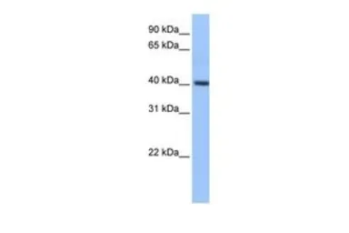 Anti-PDXK antibody, Internal used in Western Blot (WB). GTX45486