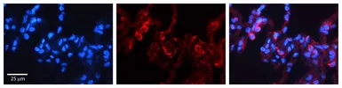 Anti-PDXK antibody, N-term used in IHC (Paraffin sections) (IHC-P). GTX45487