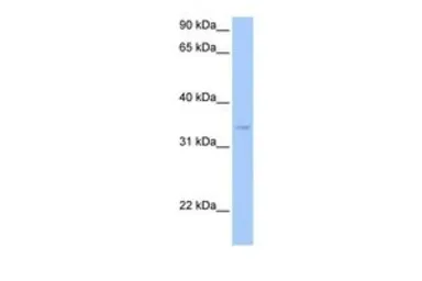 Anti-PDXK antibody, N-term used in Western Blot (WB). GTX45487