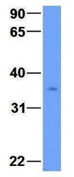 Anti-PDXK antibody, N-term used in Western Blot (WB). GTX45487