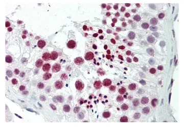 Anti-TNP1 antibody, N-term used in IHC (Paraffin sections) (IHC-P). GTX45488