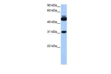 Anti-CYLC2 antibody, C-term used in Western Blot (WB). GTX45492