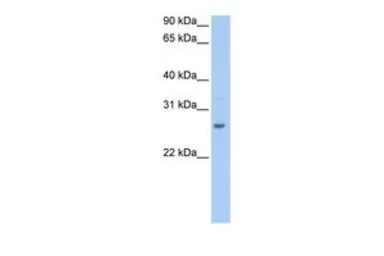 Anti-CRISP1 antibody, N-term used in Western Blot (WB). GTX45493