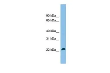 Anti-SPATA24 antibody, C-term used in Western Blot (WB). GTX45502