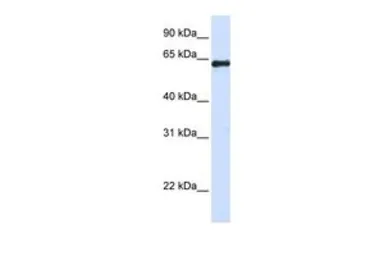 Anti-FAM116A antibody, Internal used in Western Blot (WB). GTX45505